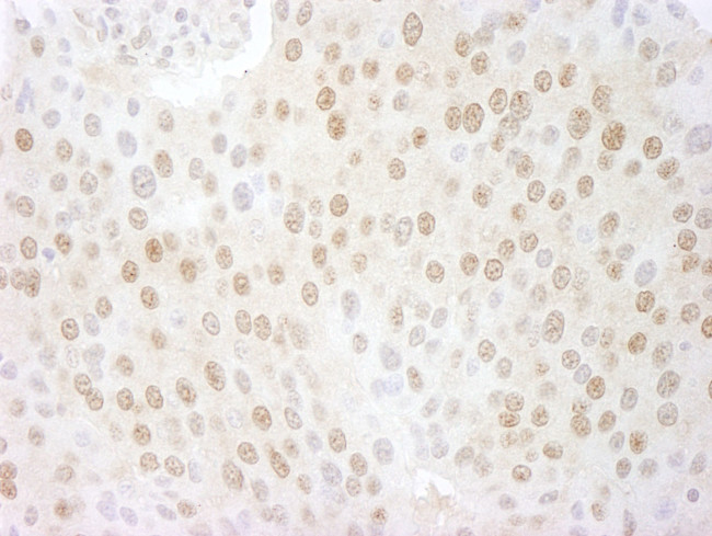 CSN5 Antibody in Immunohistochemistry (IHC)