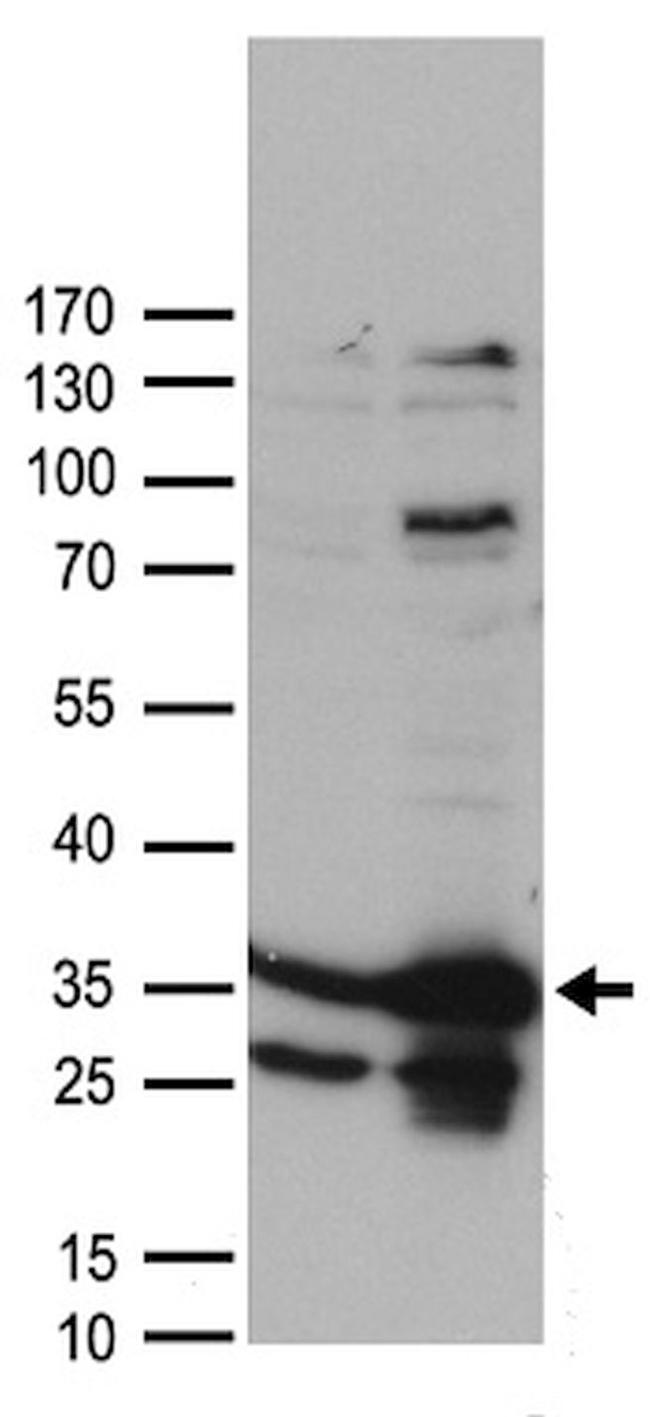 CSNK2B Antibody in Western Blot (WB)