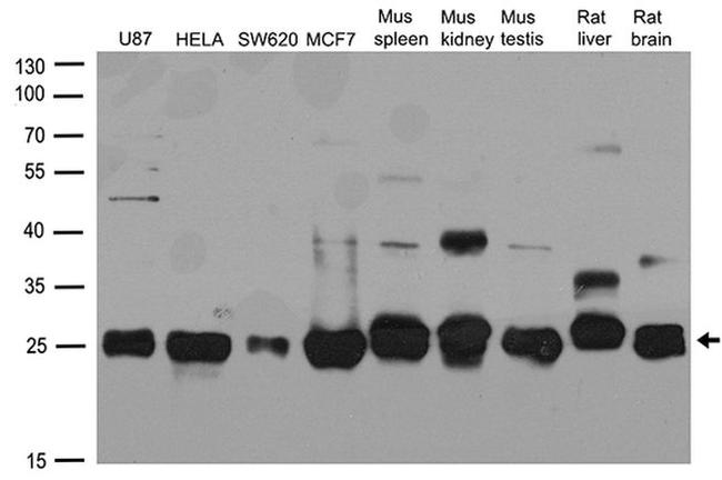 CSNK2B Antibody in Western Blot (WB)