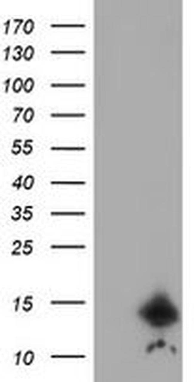 CST3 Antibody in Western Blot (WB)