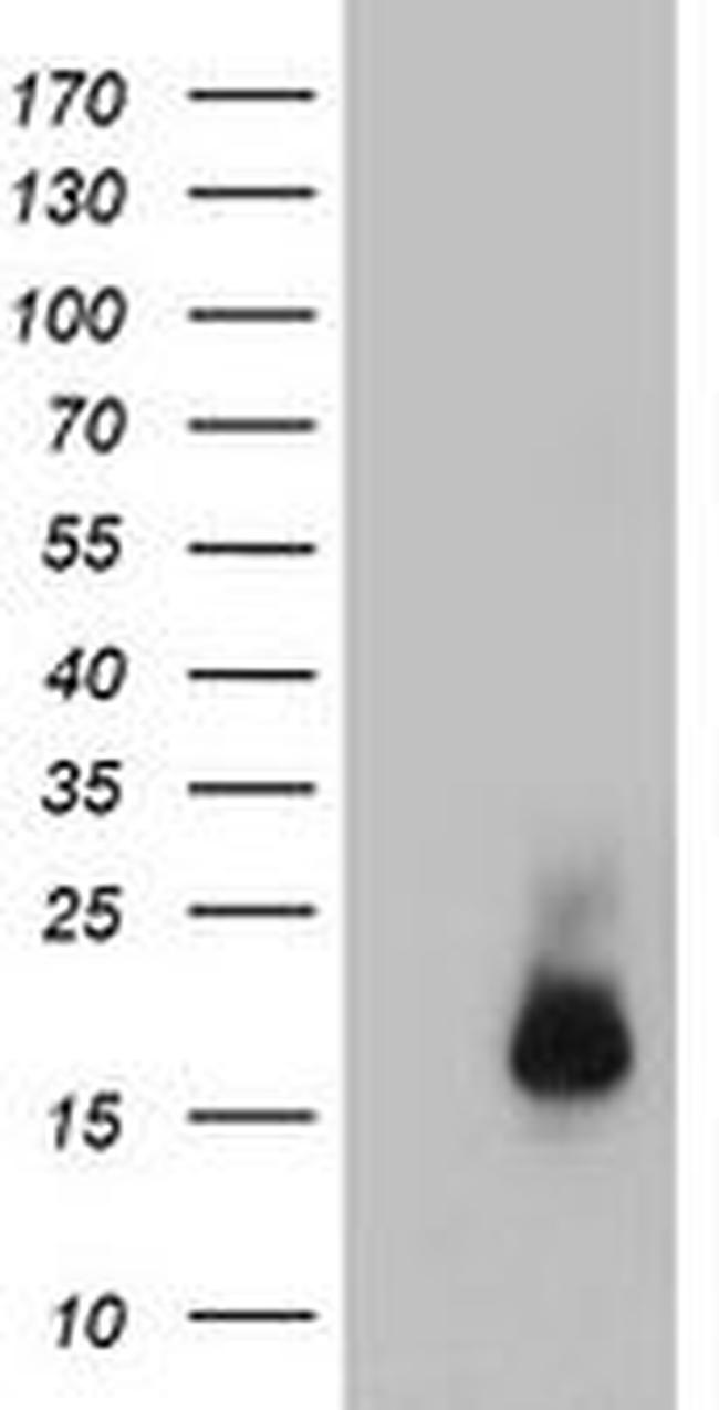 CST3 Antibody in Western Blot (WB)