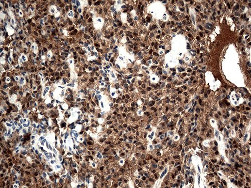 CSTB Antibody in Immunohistochemistry (Paraffin) (IHC (P))