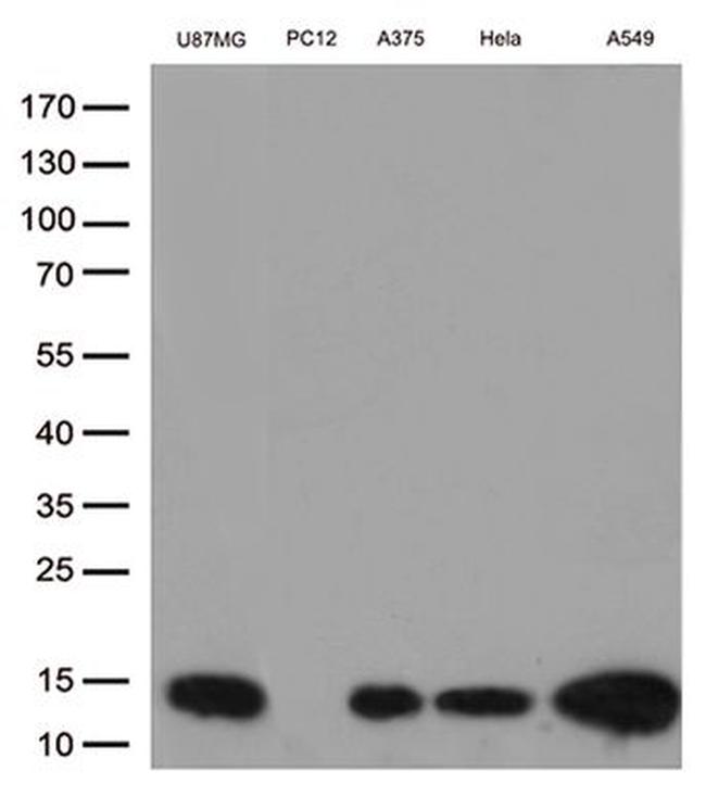 CSTB Antibody in Western Blot (WB)