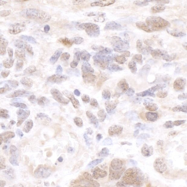 CSTF50 Antibody in Immunohistochemistry (IHC)