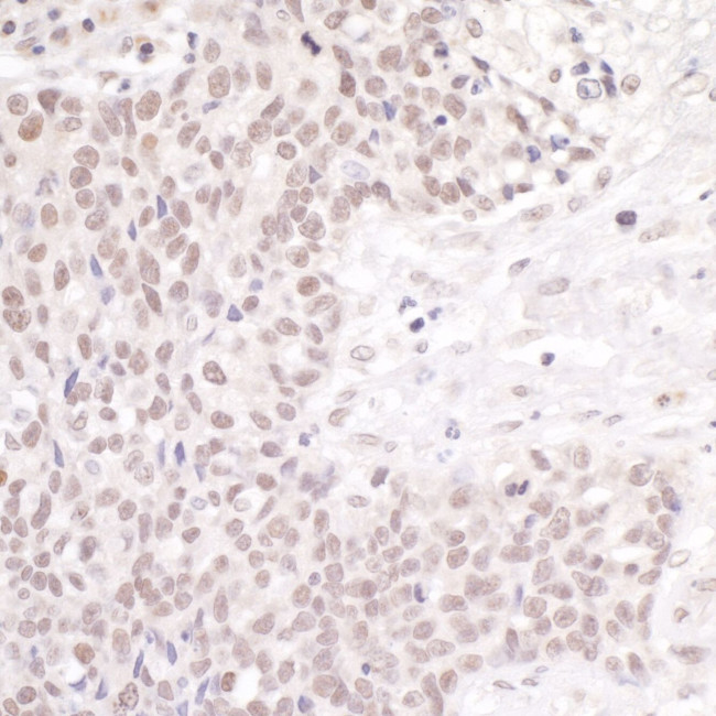 CSTF50 Antibody in Immunohistochemistry (IHC)