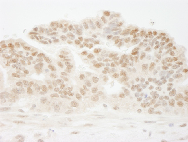 CSTF50 Antibody in Immunohistochemistry (IHC)