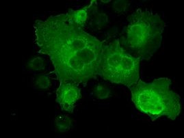 CTAG1B Antibody in Immunocytochemistry (ICC/IF)