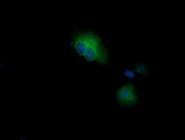 CTAG1B Antibody in Immunocytochemistry (ICC/IF)