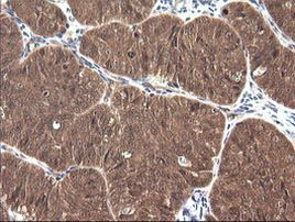 CTAG1B Antibody in Immunohistochemistry (Paraffin) (IHC (P))