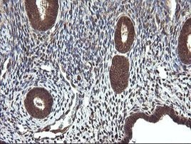 CTAG1B Antibody in Immunohistochemistry (Paraffin) (IHC (P))