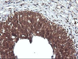 CTAG1B Antibody in Immunohistochemistry (Paraffin) (IHC (P))