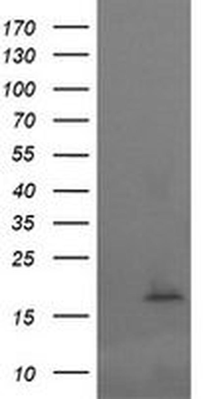 CTAG1B Antibody in Western Blot (WB)