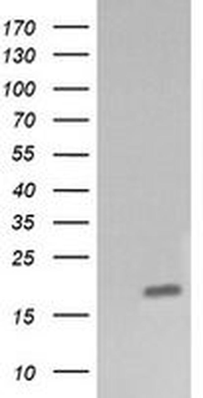 CTAG1B Antibody in Western Blot (WB)