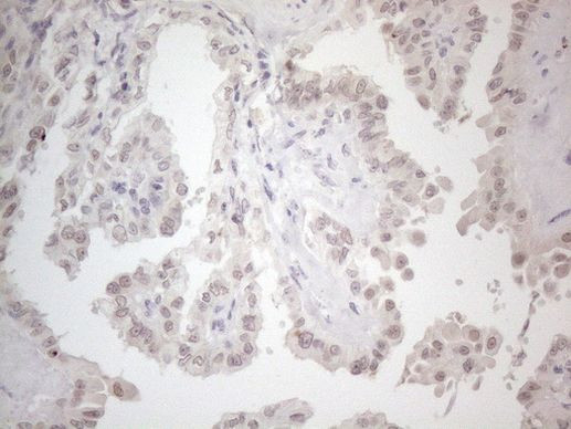 CTBP2 Antibody in Immunohistochemistry (Paraffin) (IHC (P))