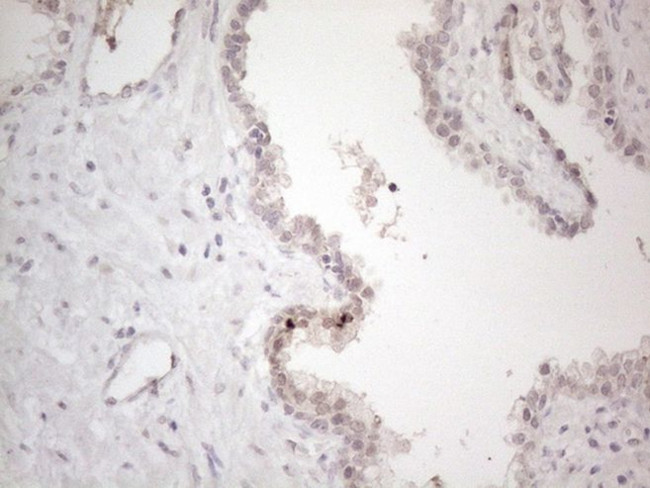 CTBP2 Antibody in Immunohistochemistry (Paraffin) (IHC (P))