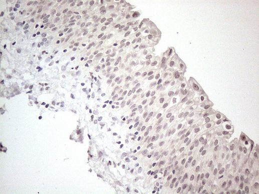 CTBP2 Antibody in Immunohistochemistry (Paraffin) (IHC (P))