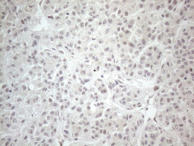 CTBP2 Antibody in Immunohistochemistry (Paraffin) (IHC (P))