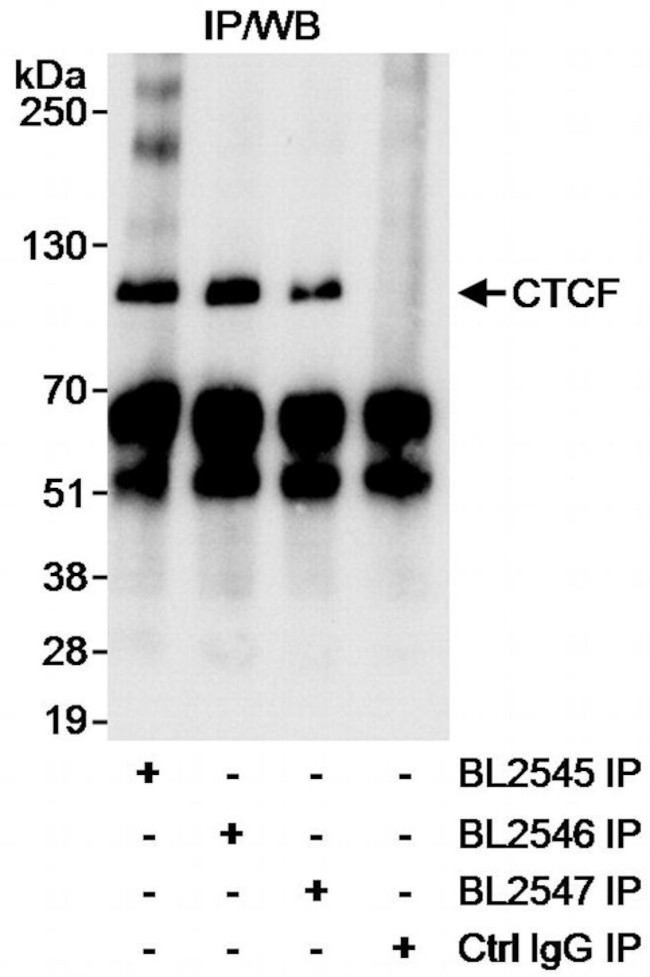 CTCF Antibody in Immunoprecipitation (IP)