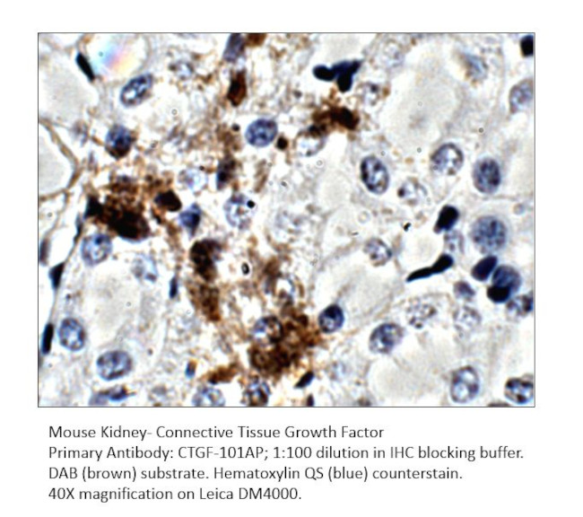 CTGF Antibody in Immunohistochemistry (IHC)