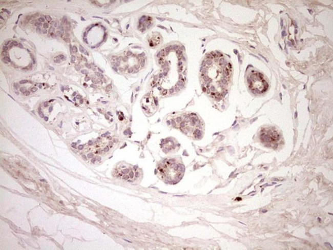 CTGF Antibody in Immunohistochemistry (Paraffin) (IHC (P))