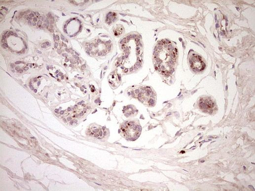 CTGF Antibody in Immunohistochemistry (Paraffin) (IHC (P))