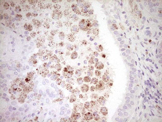 CTGF Antibody in Immunohistochemistry (Paraffin) (IHC (P))