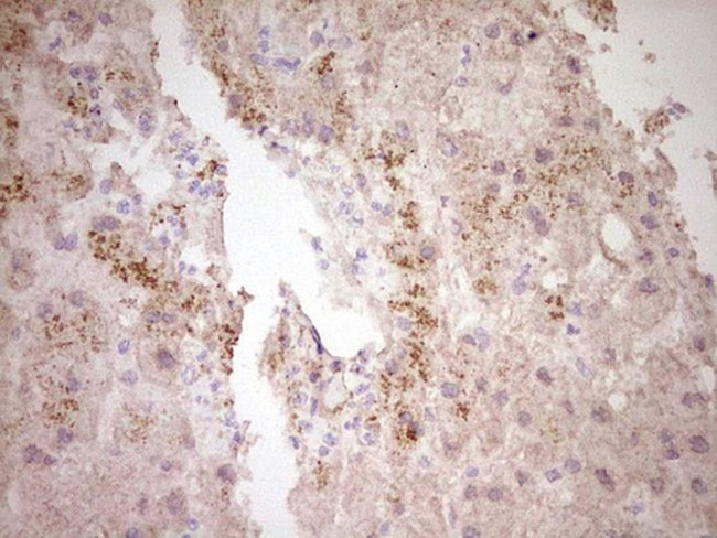 CTGF Antibody in Immunohistochemistry (Paraffin) (IHC (P))