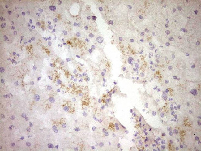 CTGF Antibody in Immunohistochemistry (Paraffin) (IHC (P))