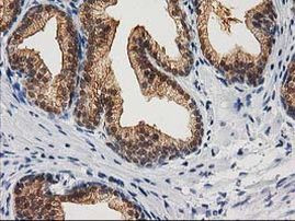 CTH Antibody in Immunohistochemistry (Paraffin) (IHC (P))