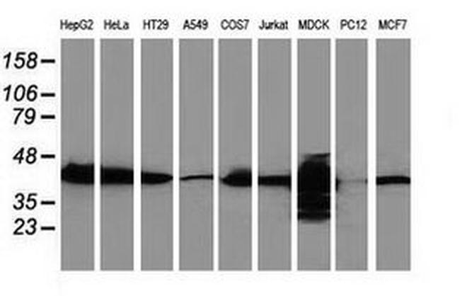 CTH Antibody in Western Blot (WB)