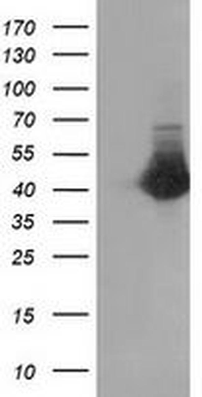 CTH Antibody in Western Blot (WB)