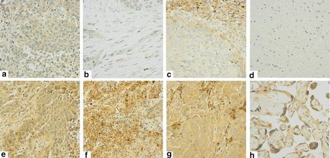 CD152 (CTLA-4) Antibody in Immunohistochemistry (IHC)