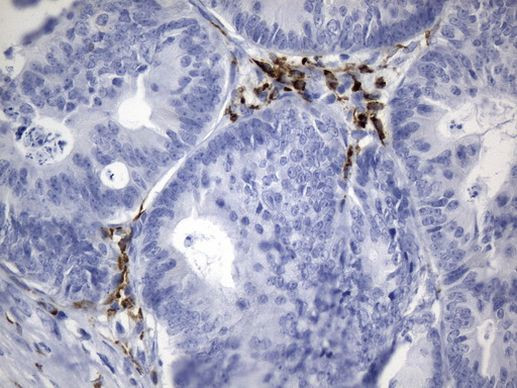 CTLA4 Antibody in Immunohistochemistry (Paraffin) (IHC (P))