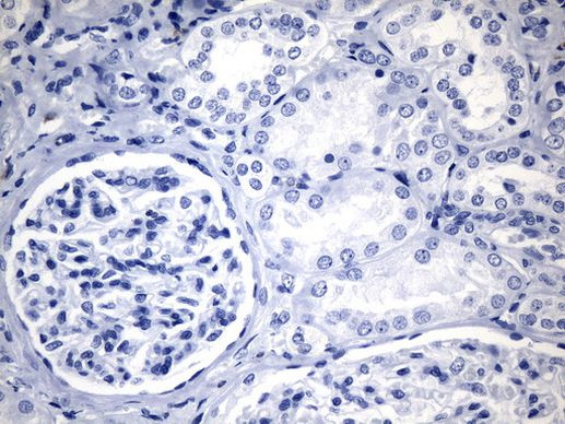 CTLA4 Antibody in Immunohistochemistry (Paraffin) (IHC (P))