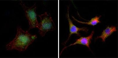 beta Catenin Antibody in Immunocytochemistry (ICC/IF)