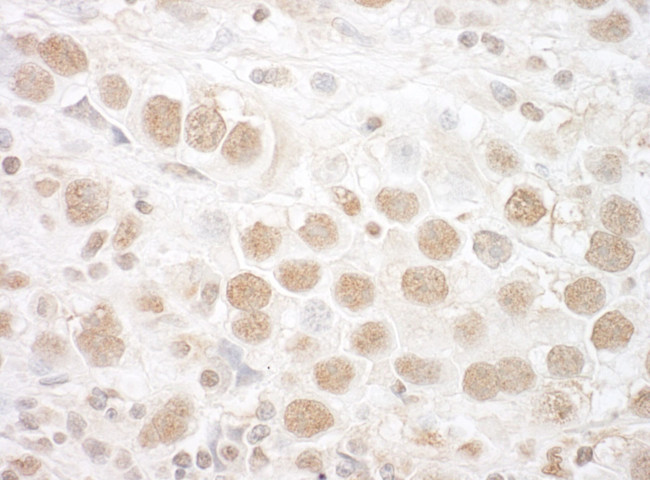 CTNNBL1 Antibody in Immunohistochemistry (IHC)