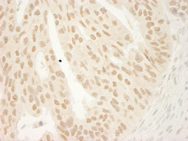 CTNND1 Antibody in Immunohistochemistry (IHC)