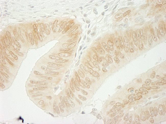 CTNND1 Antibody in Immunohistochemistry (IHC)