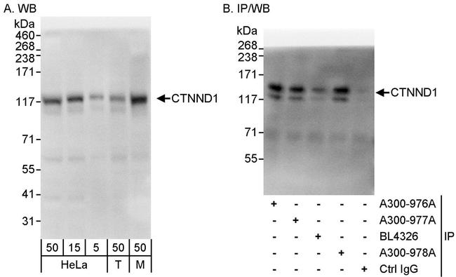 CTNND1 Antibody in Western Blot (WB)