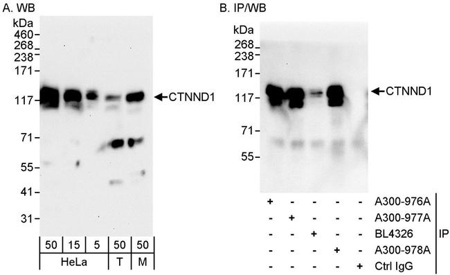 CTNND1 Antibody in Western Blot (WB)