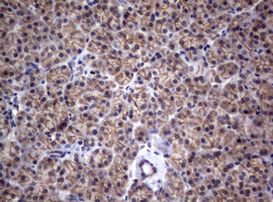 CTNND1 Antibody in Immunohistochemistry (Paraffin) (IHC (P))