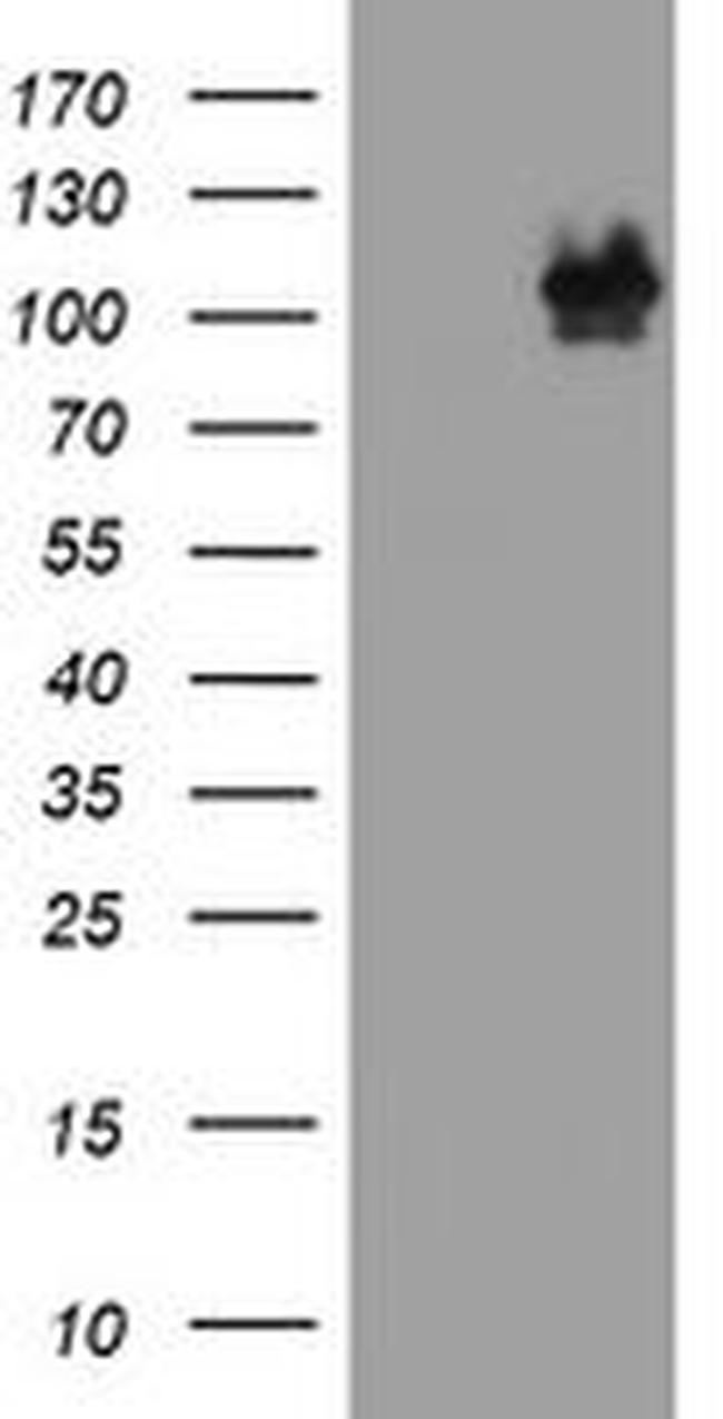 CTNND1 Antibody in Western Blot (WB)