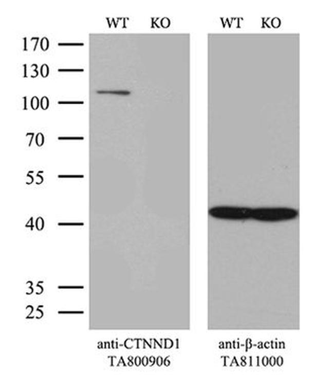 CTNND1 Antibody in Western Blot (WB)