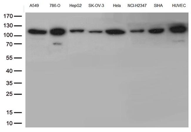 CTNND1 Antibody in Western Blot (WB)