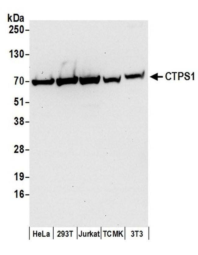 CTPS1 Antibody in Western Blot (WB)