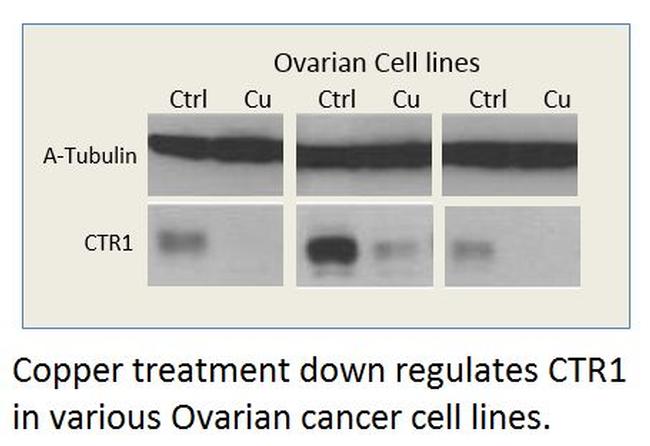 CTR1/SLC31A1 Antibody in Western Blot (WB)