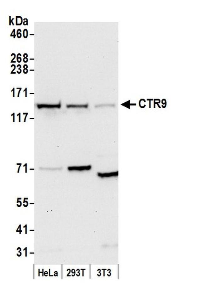 CTR9 Antibody in Western Blot (WB)