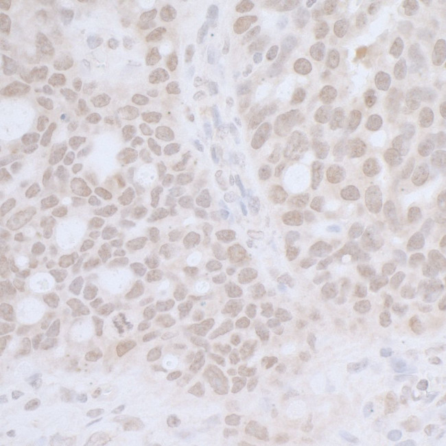 CTR9 Antibody in Immunohistochemistry (IHC)