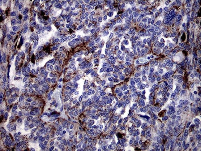 CTSL1 Antibody in Immunohistochemistry (Paraffin) (IHC (P))