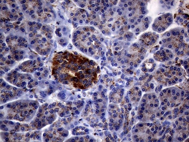 CTSL1 Antibody in Immunohistochemistry (Paraffin) (IHC (P))